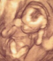 21-hafta-hamilelik-2.jpg